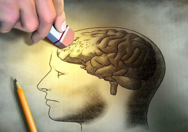 Bệnh alzheimer là bệnh sa sút trí tuệ người lớn tuổi