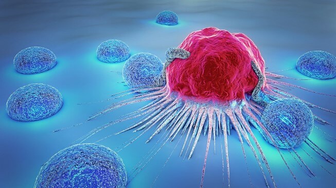 Ion giúp kiềm chế các tế bào ung thư