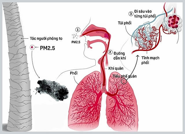 Ô nhiễm không khí là một trong những nguyên nhân gây nên các căn bệnh nguy hiểm