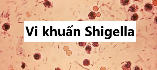 Shigella: Nguyên nhân, triệu chứng và cách phòng ngừa khuẩn Shigella