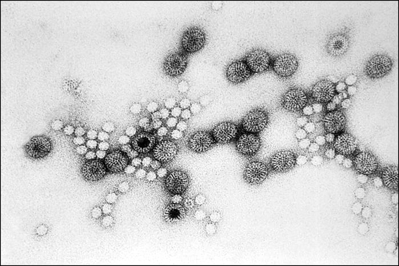 Virus Rota là một trong số các loại vi rút gây nhiễm trùng đường ruột