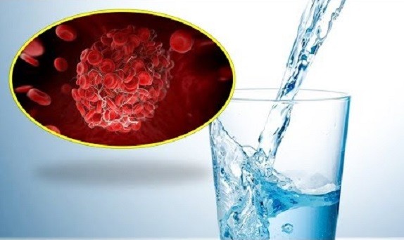 4 thời điểm bạn cần uống nước để tránh hình thành các cục máu đông