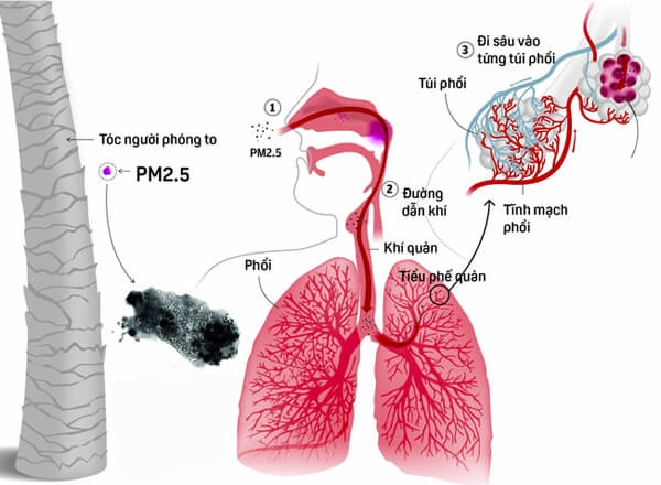 Ảnh hưởng nguy hiểm của bụi mịn PM 2.5 tới sức khoẻ